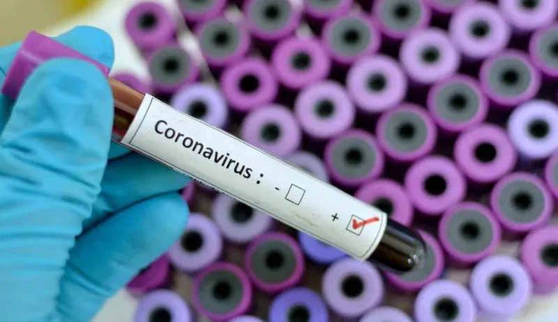 Por conta do coronavírus, há necessidade do emprego urgente de medidas de prevenção, controle e contenção de risco