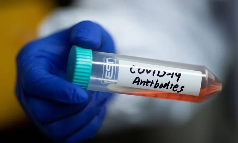 Imagem ilustrativa da imagem AL TEM MAIS DE 32 MIL CASOS DE COVID E QUASE MIL ÓBITOS