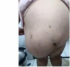 Imagem ilustrativa da imagem COM OBESIDADE, MULHER PEDE AJUDA