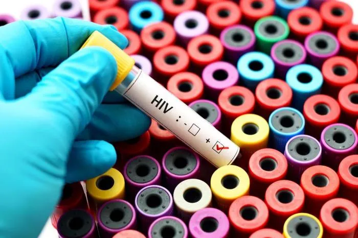 Imagem ilustrativa da imagem ESTADO REGISTRA 279 CASOS DE HIV NO PRIMEIRO SEMESTRE