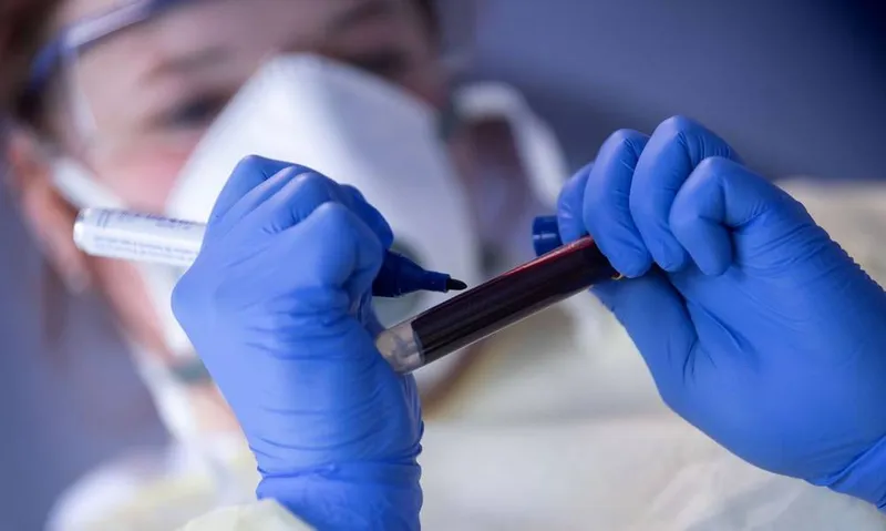 Alagoas registra atualmente 189.586 pessoas infectadas pelo novo coronavírus, conforme boletim do governo