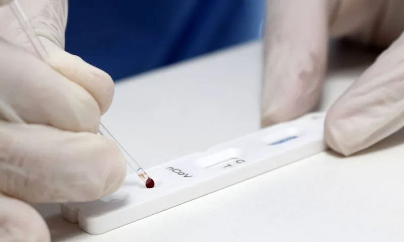 Imagem ilustrativa da imagem MACEIÓ REGISTRA QUEDA DE 40% DO NÚMERO DE TESTES PARA COVID