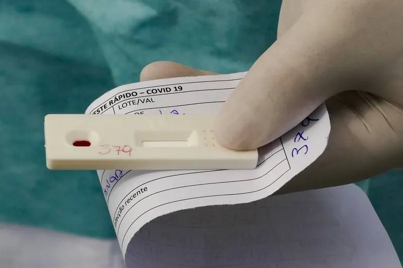 Imagem ilustrativa da imagem REALIZAÇÃO DE TESTES RÁPIDOS EM FARMÁCIAS RECUA 36,4%