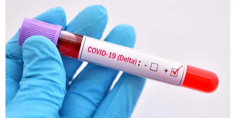 Imagem ilustrativa da imagem SOBE PARA 12 NÚMERO DE CASOS DE INFECÇÃO PELA VARIANTE DELTA EM AL
