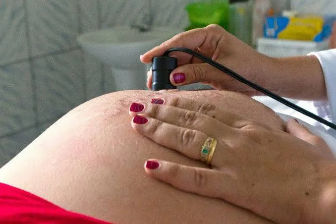 Imagem ilustrativa da imagem AL REGISTRA MENOR NÚMERO DE CASOS DE GRAVIDEZ NA ADOLESCÊNCIA EM 5 ANOS