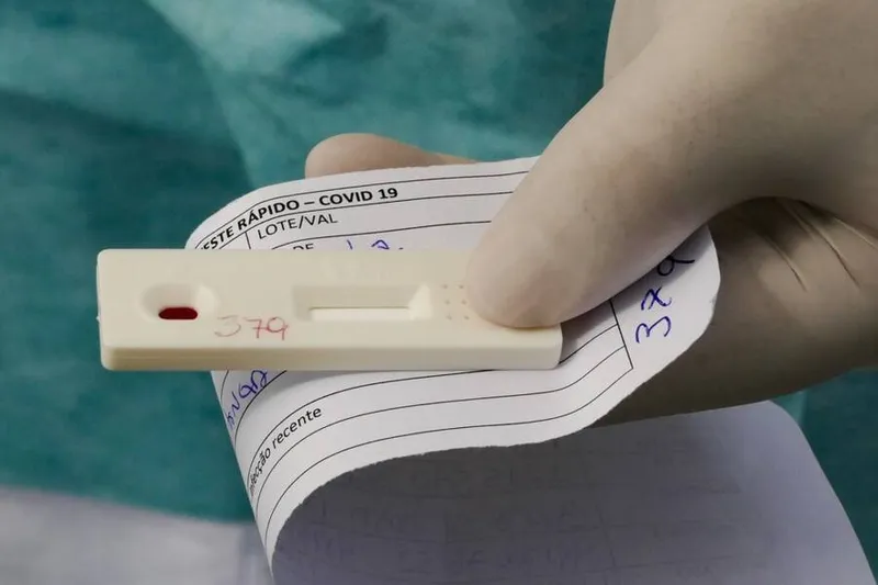 Imagem ilustrativa da imagem PROCON NOTIFICA LABORATÓRIOS E FARMÁCIAS DE AL SOBRE PREÇOS DE TESTES PARA COVID-19