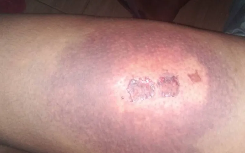A Polícia Militar de Alagoas afirma que agiu em reação às agressões do trio