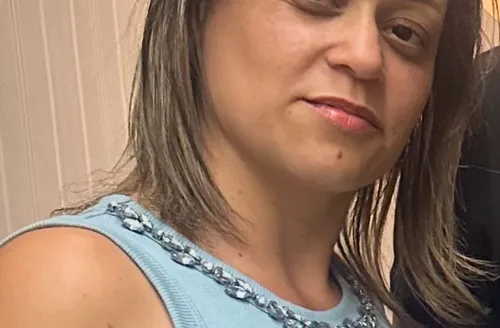 Transplante capilar feminino cresce no Brasil e impulsiona autoestima das mulheres