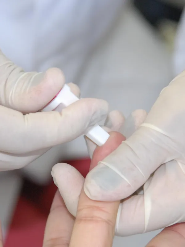 Alagoas registra queda de 28,65% nos casos de hepatite viral