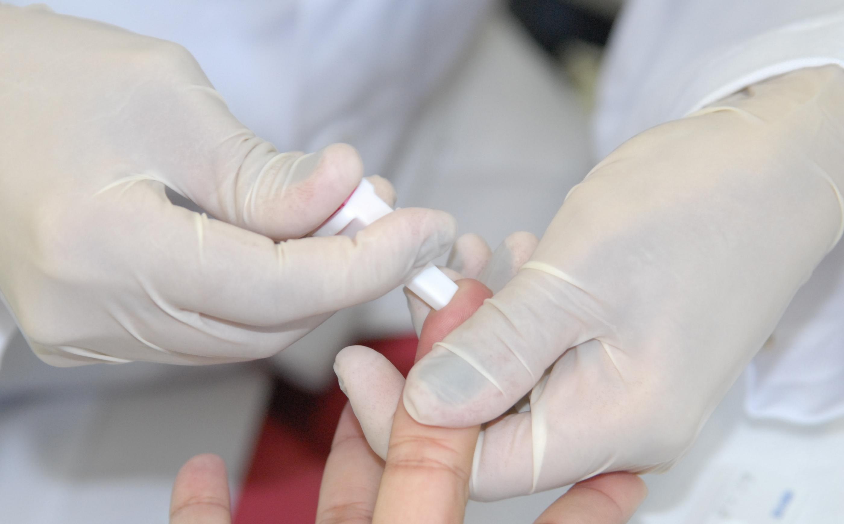 Sesau orienta como prevenir, diagnosticar e tratar as hepatites virais