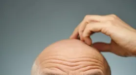 Eles também merecem: saiba como cuidar da pele da cabeça dos carecas