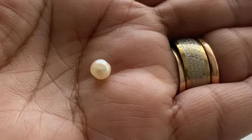 Família acusa Hapvida de negligência no atendimento a menino de 4 anos - Imagem