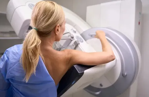 Exames de imagem são aliados essenciais para detecção precoce do câncer de mama