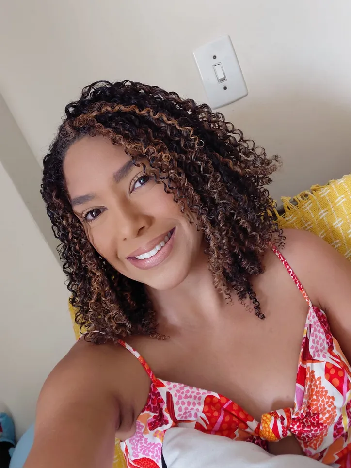 Bianca Stephanie recorre a maquiagem para disfarçar manchas