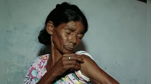 Idosa espancada em via pública relata dores pelo corpo; filha está presa - Imagem