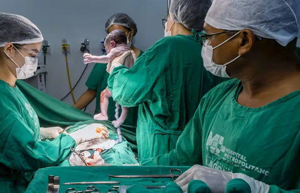 Partos normais caem 16%, e cesáreas chegam a 58% dos nascimentos em AL