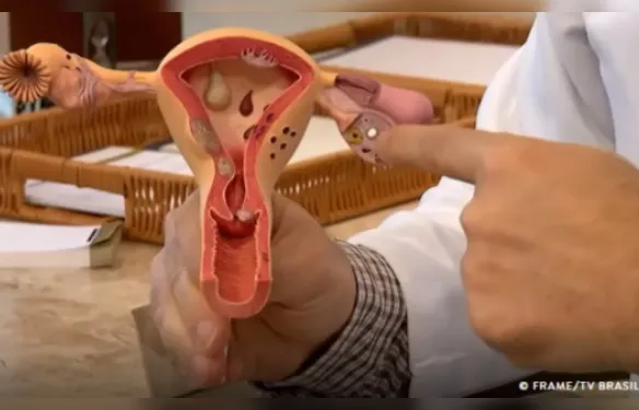 Instituto estima 350 novos casos de câncer do colo do útero em Alagoas neste ano