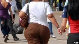 Justiça condena plano a custear cirurgias reparadoras pós-obesidade