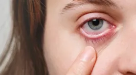 Mais de 500 casos de conjuntivite são registrados em três meses nas UPAs da capital alagoana