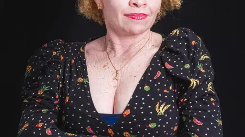 Alagoas tenta tirar população albina da ‘fila da invisibilidade’ - Imagem