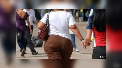 Justiça condena plano a custear cirurgias reparadoras pós-obesidade - Imagem