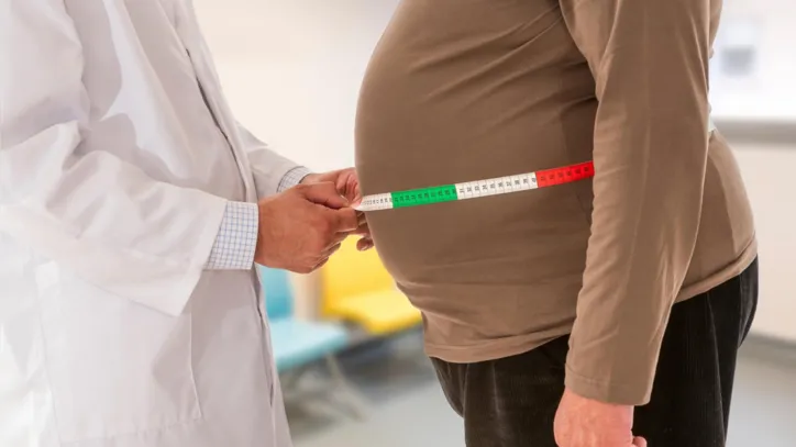 Imagem ilustrativa da imagem Abeso divulga nova diretriz para tratamento da obesidade