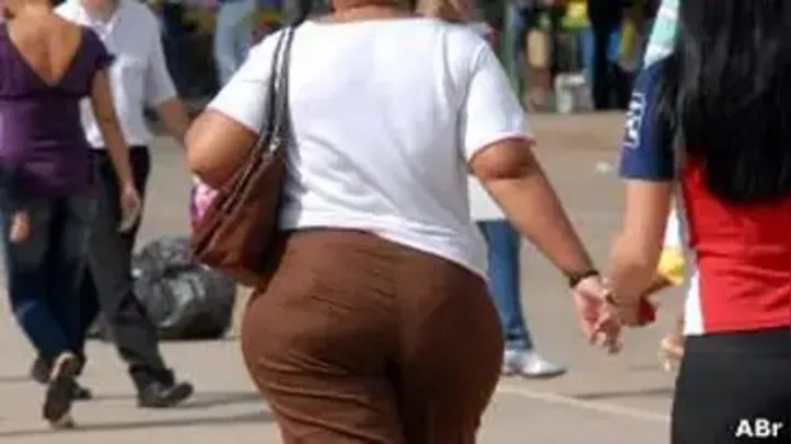 Paciente fez cirurgia bariátrica e perdeu 30 kg