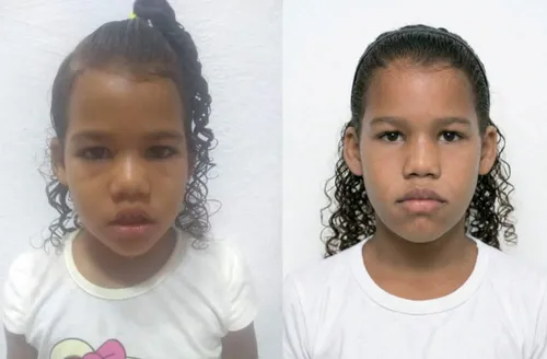 Alagoas registra 49 casos de crianças desaparecidas em pouco mais de um ano