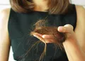 O que o inverno tem a ver com a queda de cabelo? Entenda essa relação