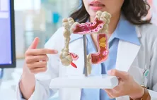 Diagnóstico precoce pode curar mais de 90% dos casos de câncer de intestino