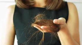 O que o inverno tem a ver com a queda de cabelo? Entenda essa relação