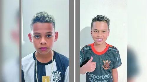 Correção de orelhas proeminentes devolve autoestima a pacientes - Imagem