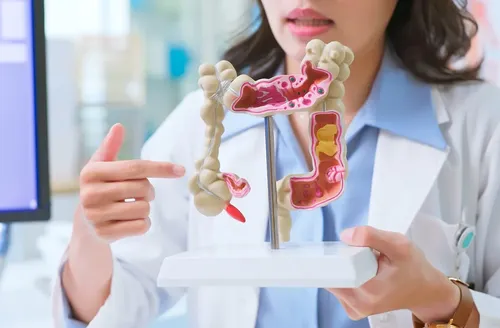 Diagnóstico precoce pode curar mais de 90% dos casos de câncer de intestino