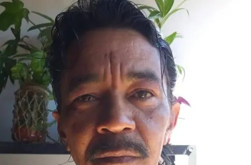 Morre sobrevivente do acidente com o césio-137 em Goiás
