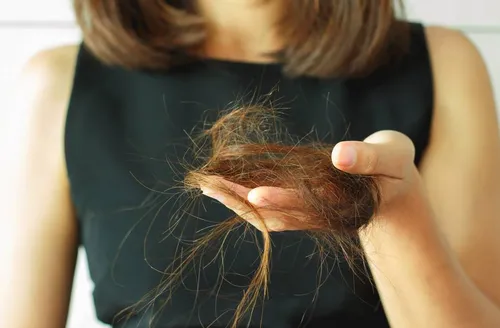 O que o inverno tem a ver com a queda de cabelo? Entenda essa relação