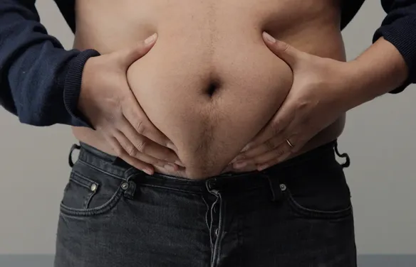 Gordura na barriga pode revelar risco cardíaco despercebido pelo IMC