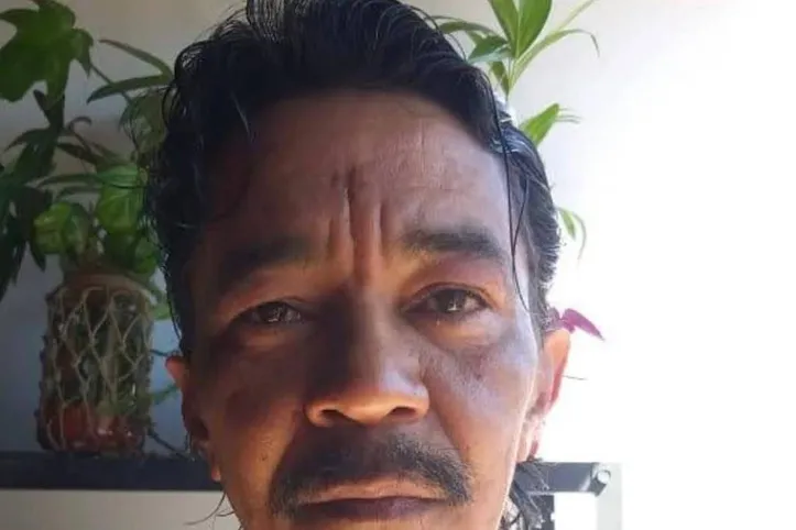 Lucimar das Neves Ferreira, um dos sobreviventes do césio-137