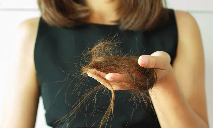 Imagem ilustrativa da imagem O que o inverno tem a ver com a queda de cabelo? Entenda essa relação