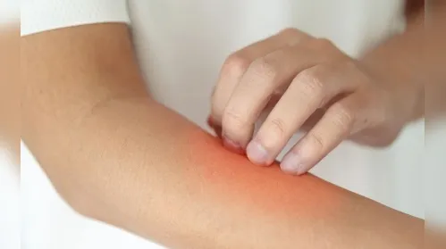 Conheça os sinais silenciosos de que o seu fígado pode não estar bem - Imagem