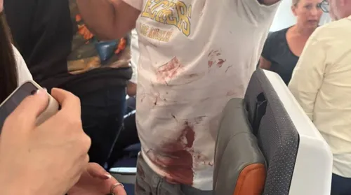 Piloto esfaqueia comandante em avião com destino a Israel - Imagem