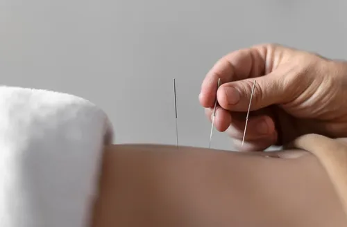 Ansiedade: acupuntura auxilia, mas não substitui o tratamento