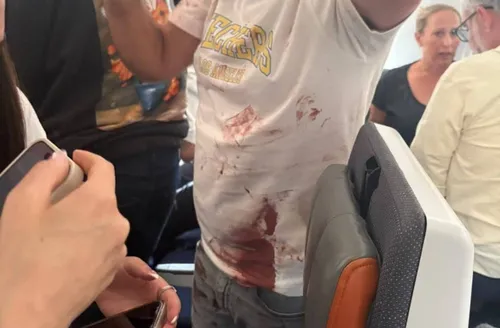 Piloto esfaqueia comandante em avião com destino a Israel