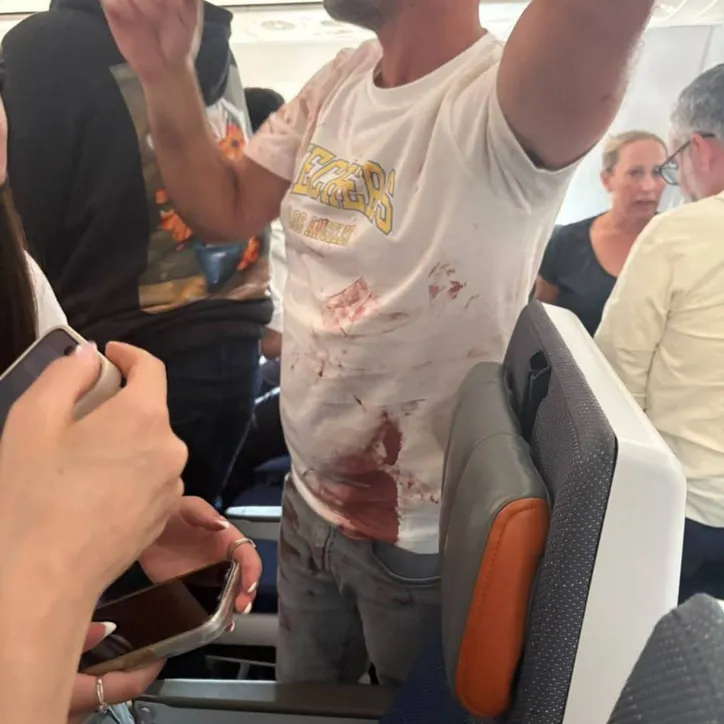 Passageiro com manchas de sangue nas roupas após incidente