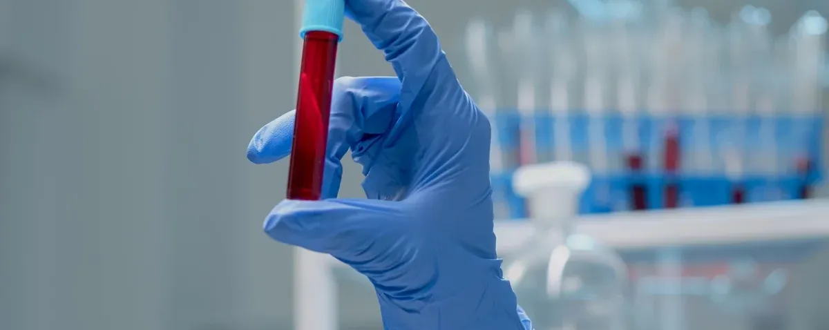 Exame de sangue que detecta mais de 50 tipos de câncer chega ao Brasil