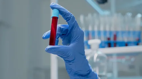 Exame de sangue que detecta mais de 50 tipos de câncer chega ao Brasil - Imagem
