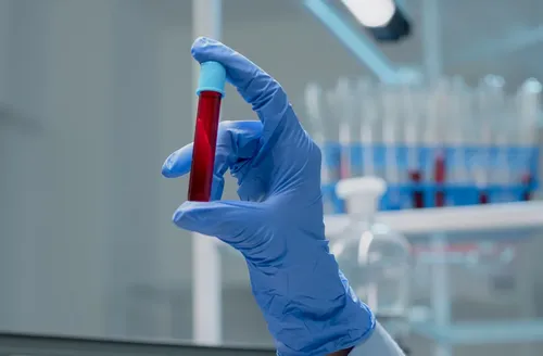 Exame de sangue que detecta mais de 50 tipos de câncer chega ao Brasil
