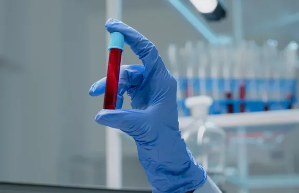 Exame de sangue que detecta mais de 50 tipos de câncer chega ao Brasil