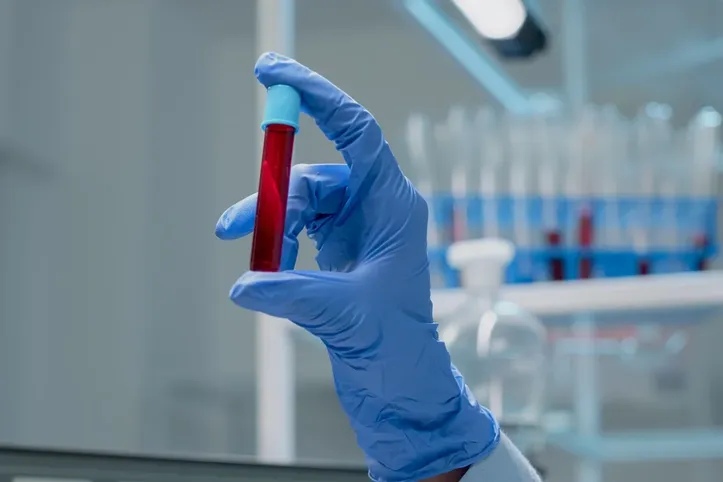 Novo exame de sangue que detecta células cancerígenas chega ao Brasil